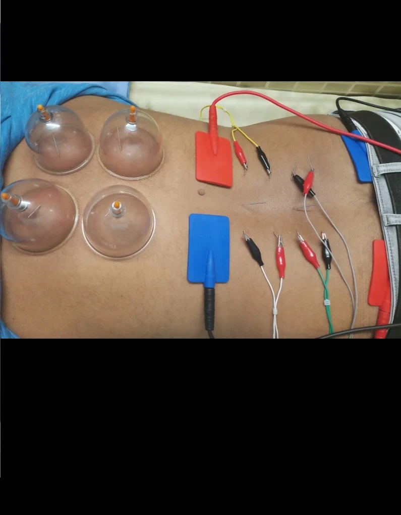 Clinic treatment photo 12